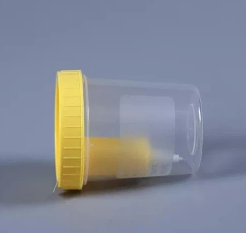 Urine Container Disposable Urine Container
